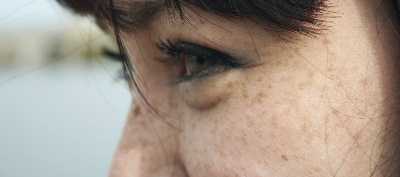 Close-up of a woman’s eye and cheek in soft daylight, with freckles and fine lines visible