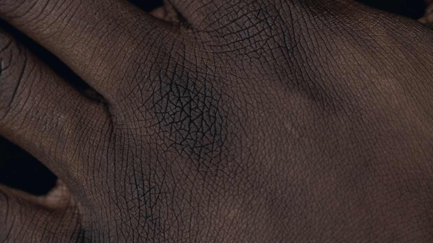The back of a hand with deep brown skin, showing fine surface texture