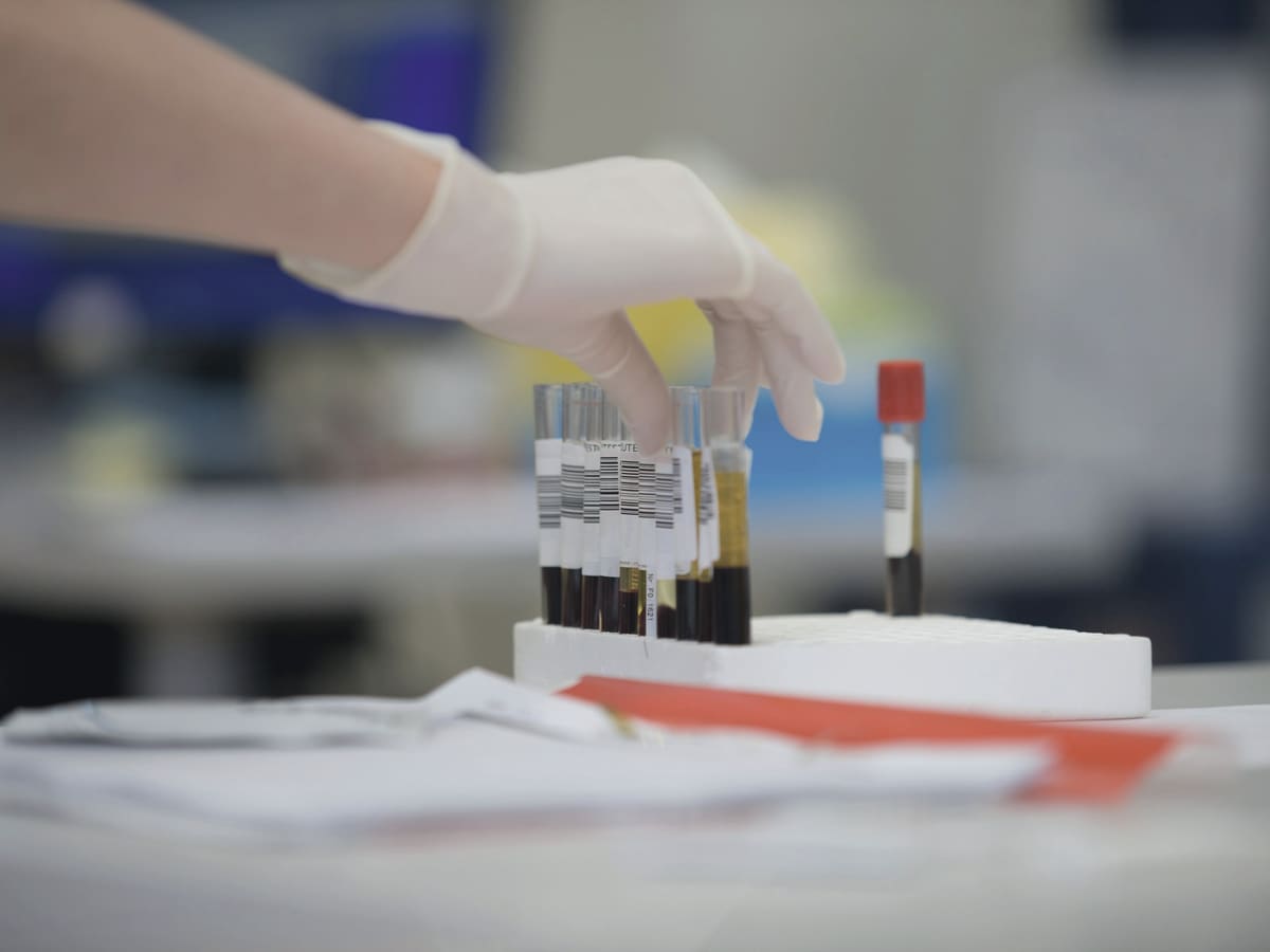 A gloved hand places labelled blood sample tubes into a rack on a laboratory bench.
