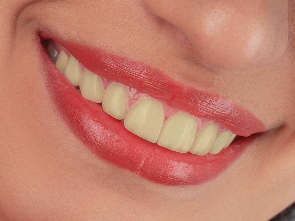 Simulated before: darker, uneven shade